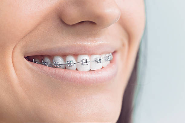 Best Invisalign and Clear Aligners  in Winnie, TX